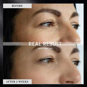 Crème pour les yeux anti-rides et anti-poches à l'acide hyaluronique, au rétinol et à la vitamine C, marque privée OEM - Product Image 2