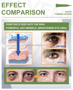 Ensemble de crème naturelle anti-âge raffermissante pour les yeux de Corée, marque privée - Product Image 3