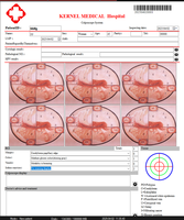 Diagnostic Instrument Kernel Full HD Digital Video Colposcope for Accurate Gynecological Examinations and Cervical Screening