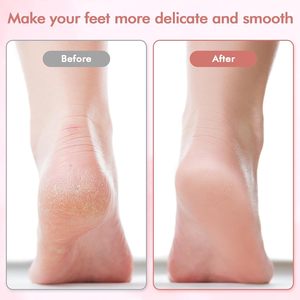 Mini Removedor Eléctrico <span class=keywords><strong>de</strong></span> Callos y Lima para Pies, Herramienta <span class=keywords><strong>de</strong></span> Pedicura Portátil Recargable para Exfoliar la Piel Muerta y Cuidado <span class=keywords><strong>de</strong></span> los Pies - Product Image 3