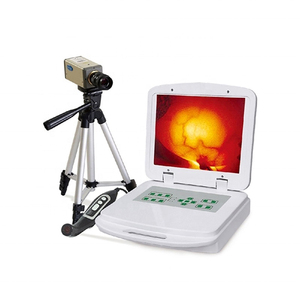 Medical Infrared Mammary Gland Inspection Equipment Breast Examination Diseases Diagnostic Equipment