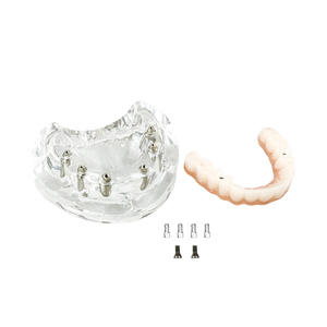 Modelos Dentales de Resina a Precio de Fábrica, Modelos de Implantes Dentales Maxilares y Dentaduras Postizas Reutilizables para Entrenamiento y Uso Educativo - Product Image 3