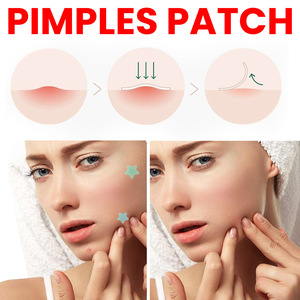2024 venta al por mayor Jaysuing hidrocoloide acné espinillas parche para cubrir zits forma de estrella colorida parche de tamaño especial - Product Image 3