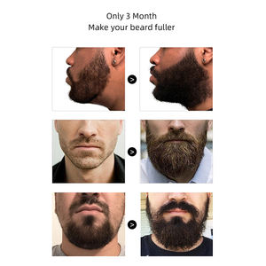 Huile à <span class=keywords><strong>barbe</strong></span> personnalisée en gros, emballage sur mesure, marque privée, meilleure huile pour la croissance de la <span class=keywords><strong>barbe</strong></span>, huile naturelle, biologique, végane pour la croissance de la <span class=keywords><strong>barbe</strong></span> - Product Image 3