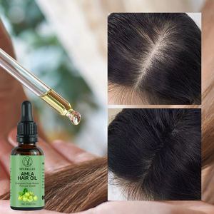 Herbals <span class=keywords><strong>Amla</strong></span> Shampooing Chute de cheveux naturelle et dommages Nettoyant à base de plantes Anti-perte de cheveux Renforcement et nourrissant Ensemble de shampooing pour la croissance des cheveux - Product Image 6