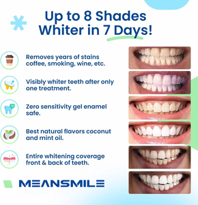 2024 mới tốt nhất người bán 14 phương pháp điều trị làm trắng răng U Dải người da trắng beaconsfield cao cấp răng làm trắng dải - Product Image 6