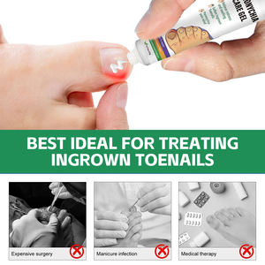 OEM Paronychia уход Гель противогрибковый Крем для эффективного ухода за ногами и ногтями - Product Image 2