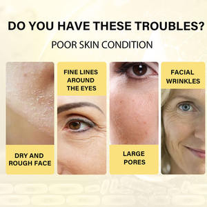 Kit de lifting par fils de protéines EELHOE, remplissage facial, fils de protéines de collagène absorbables, raffermissant, anti-âge, essence faciale - Product Image 4