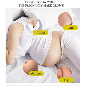 Rimuovere le smagliature <span class=keywords><strong>crema</strong></span> Anti rughe bellezza sbiancamento della pelle riparazione della cicatrice smagliature <span class=keywords><strong>crema</strong></span> per la gravidanza - Product Image 3