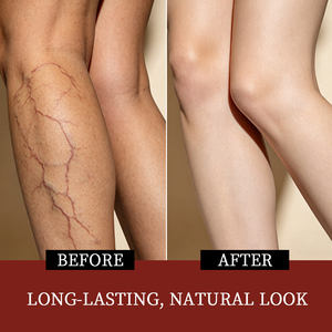 Wholesale Gentle Ingredients Daily Body Care Reduces Discomfort Nourishing Soothing Moisturizing <strong>Varicose</strong> <strong>Veins</strong> <strong>Relief</strong> <strong>Cream</strong> - Product Image 2