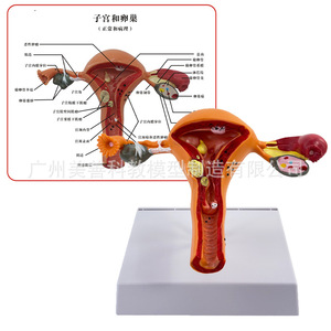 Sistema reproductor femenino humano: modelo anatómico y patológico del útero, la vagina y los ovarios; material didáctico para - Product Image 1