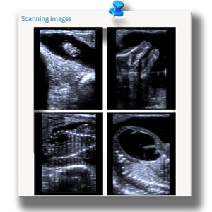 เครื่องตรวจสอบสัตวแพทย์เครื่องสแกนอัลตร้าซาวด์สำหรับสุนัขเลี้ยงแกะวัว-สำหรับการสแกนการตั้งครรภ์ - Product Image 5