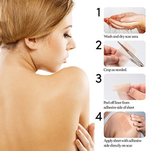 Patch de couverture élastique invisible en gel de silicone <span class=keywords><strong>pour</strong></span> la réparation des <span class=keywords><strong>cicatrices</strong></span> de césarienne rouge écarlate - Product Image 1