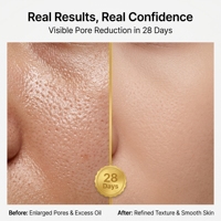 Sérum Liquide Botanique Resserre les Pores avec Acide Hyaluronique, Hamamélis et Centella pour le Contrôle du Sébum du Visage et du Nez 30mL OEM/ODM