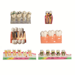 Modelo de Enseñanza Dental de Resina Desmontable para Cepillo de Dientes, Molde para Equipos de Terapia Oral, Accesorios Dentales - Product Image 4