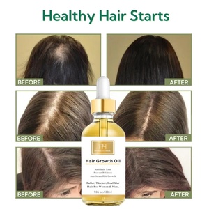 Minyak rambut Rosemary untuk pertumbuhan Halr 1.06 FL. OZ kulit kepala alami murni <span class=keywords><strong>Ol</strong></span> dengan minyak esensial perawatan nutrisi untuk Split Ends - Product Image 6