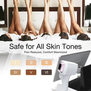 Macchina Laser per Epilazione Non-Cristallina FAC con Sistema Android <span class=keywords><strong>Smart</strong></span> 808nm per Cliniche - Product Image 6