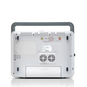 Mesin Ekokardiografi SonoScape/Pemindai Ultrasonografi Portabel untuk Manusia - Product Image 5