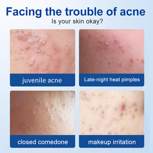 Dermvrije 180 Tabletten/Doos Waterdichte Acne Patch Onzichtbare Make-Up-Vriendelijke Hypoallergeen Voor Gevoelige Huid Vrouwelijke Hygiëne - Product Image 3