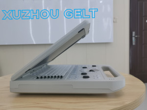 Layar LED 15 "resolusi tinggi Harga Murah mesin Ultrasound 3D jantung pembuluh darah - Product Image 4