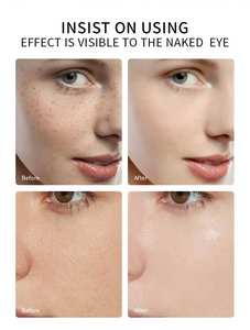 Сыворотка для лица ниацинамида, увлажняющая формула для уменьшения пор кожи, осветляет тон кожи, замедляет старение с помощью витамина B5 - Product Image 6