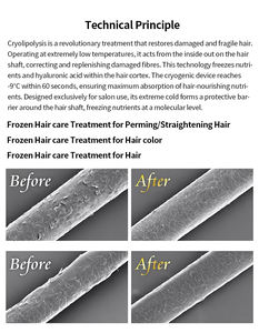 EcoDerm <span class=keywords><strong>Appareil</strong></span> de lissage des cheveux portable en acier inoxydable pour usage domestique, traitement à froid par lumière bleue, pince chaude - Product Image 3