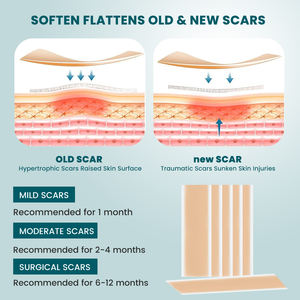 Tiras Adhesivas Reutilizables de Grado Médico para Eliminar Cicatrices, Ecológicas y a Base de Hierbas, para Cirugía de Cesárea y Cuidado de la Salud - Product Image 6