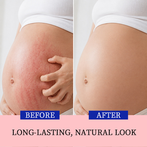 Gel Apaisant et Rafraîchissant pour le Corps avec Logo Personnalisé – Formule Apaisante et Relaxante pour Peaux Sèches et Enflées – Idéal pour les Futures Mamans - Product Image 2