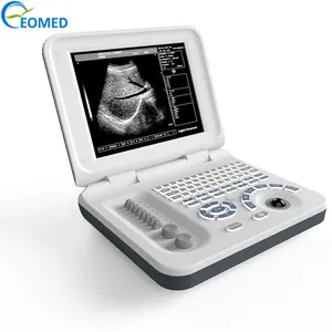 En ucuz fabrika fiyat dizüstü ultrason tarayıcı taşınabilir dijital ultrasonik teşhis makinesi ile otomatik prob BW27
