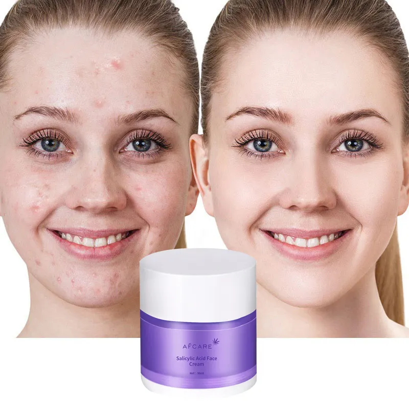 Wholesale Private Label Organic Facial Beauty Skin Care Day And Night Cream Anti Aging Anti Acne Salicylic Acid Face Cream
