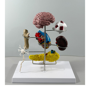 Modelo de Enseñanza de Anatomía Humana para Ciencias Médicas: Pie Diabético para Educación en Endocrinología y Patofisiología, Escuela de Medicina - Product Image 3