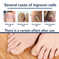 Autocollants de correction des ongles et patchs de soin pour l'art des ongles, baume pour les ongles incarnés du pied