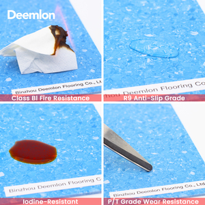 พื้น<span class=keywords><strong>ไว</strong></span><span class=keywords><strong>นิล</strong></span>แบบม้วนสำหรับโรงพยาบาล ผลิตจาก PVC คุณภาพส่ง พร้อมคุณสมบัติกันลื่นและทนไฟ แผ่น<span class=keywords><strong>ไว</strong></span><span class=keywords><strong>นิล</strong></span>แบบโฮโมจีเนียสสำหรับการดูแลสุขภาพเชิงพาณิชย์ - Product Image 3