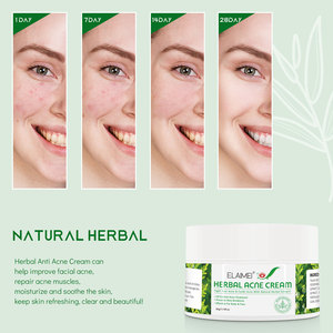<span class=keywords><strong>Crema</strong></span> para el Acné con Aceite de Árbol de Té OEM, Fórmula Vegana Orgánica con Glicerina para Todo Tipo de Piel - Hidratante y Elimina Cicatrices - Product Image 3