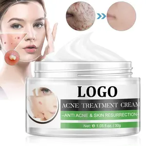 Private Label Natürliche Hautpflege Akne Klare Pickel-Behandlungs creme Anti-Akne-Anti-Falten-Creme