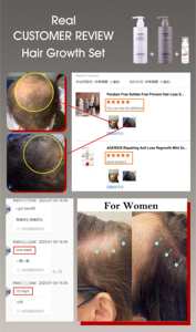 एगेरिओस अदरक हरी क्रीम शैम्पू कंडीशनर कार्बनिक प्राकृतिक तेल बालों के एंटी-हेयर लॉस रेवरोथ | 2-इन-1 बायोटिन डर्ट ब्लॉकर | - Product Image 6