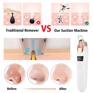 USB Portable Electric Vacuum <strong>Suction</strong> <strong>Blackhead</strong> Remover Skin Care Facial Pore Cleaner for Acne Pimple &amp; <strong>Blackheads</strong> for Home Use - Product Image 3