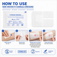 Pansement de fixation IV stérile auto-adhésif de qualité médicale en non-tissé certifié CE ISO pour canules IV, fabriqué par un OEM, Ozone