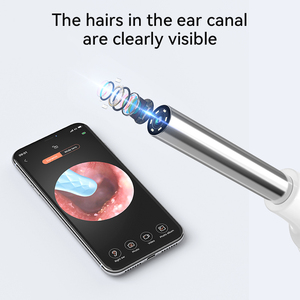 OEM Wifi Connect Vision 1080P 3-Axis Gyroscope Electric <strong>Ear</strong> Wax Remover Cleaning <strong>Camera</strong> HD <strong>Ear</strong> Care Tool <strong>Ear</strong> <strong>Cleaner</strong> <strong>with</strong> <strong>Camera</strong> - Product Image 2
