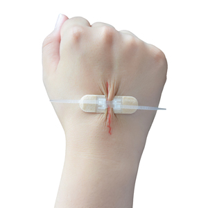 Transparente Zip Stitch Sutures Kit Bandagen mit Reiß verschluss Butterfly Surgical Skin Wound Closure Device Band Aid <span class=keywords><strong>Patch</strong></span> - Product Image 5