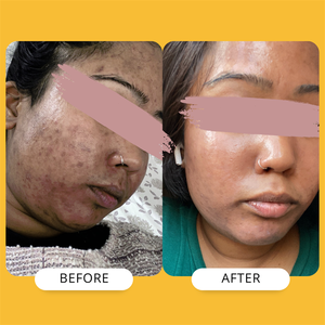 <span class=keywords><strong>Crema</strong></span> profesional de cúrcuma con vitamina C a buen <span class=keywords><strong>precio</strong></span> - Product Image 6