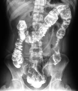 Instruments d'imagerie clinique approvisionnement d'usine Durable 17*17 détecteur sans fil à écran plat alimentation électrique à sortie claire pour les hôpitaux - Product Image 5