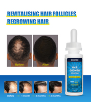 Traitement de repousse des cheveux du fabricant de produits, sérum de croissance des cheveux pour hommes, huile de croissance des cheveux naturelle, étiquette privée