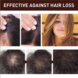 Venta al por mayor 100% natural orgánico vegano aceite para el crecimiento del cabello <span class=keywords><strong>de</strong></span> etiqueta privada suero para el crecimiento del cabello - Product Image 4