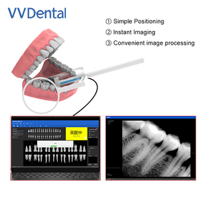 Sensor Digital de Alta Definición para Radiografía Intraoral, RVG, para Clínicas Dentales o Veterinarias - Product Image 3