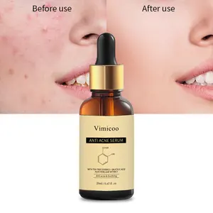 Sérum de traitement Anti-acné à base de tisane biologique de marque privée, acide salicylique, pour la peau du visage, pour l'élimination de l'acné