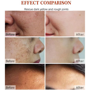 Venta al por mayor crema antipecas manchas de decoloración brillo hidratante espinillas removedor de manchas oscuras crema blanqueadora - Product Image 5