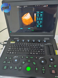 Échographe <span class=keywords><strong>Doppler</strong></span> couleur 3D 4D <span class=keywords><strong>portable</strong></span> avec imagerie échographique pour un diagnostic complet - Product Image 5