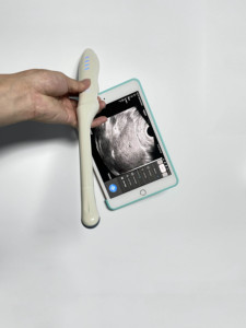 Transvaginale Array <span class=keywords><strong>Endocavity</strong></span> Ultrasone Draadloze Ultrasound <span class=keywords><strong>Probe</strong></span> - Product Image 5