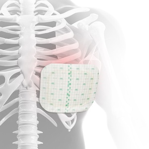 Instruments orthopédiques Attelle thoracique pour orthopédie - Product Image 1